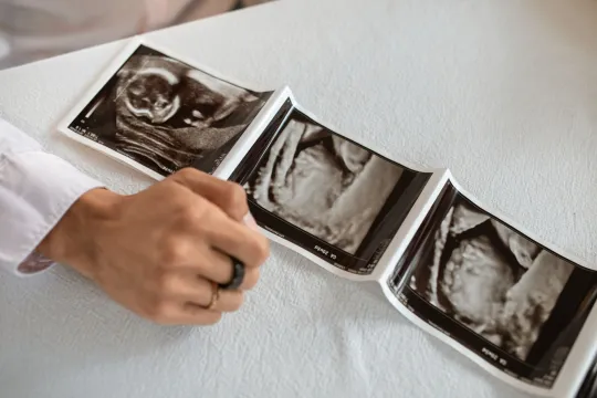 12 Week Scan: What to Expect, Week by Week