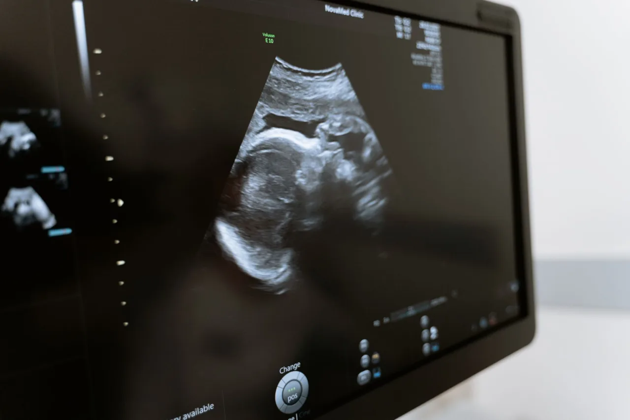 12 Week Scan: What to Expect, Week by Week