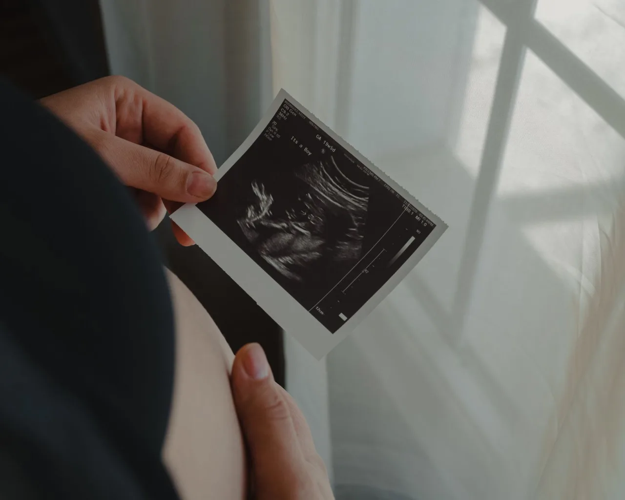 12 Week Scan: What to Expect, Week by Week