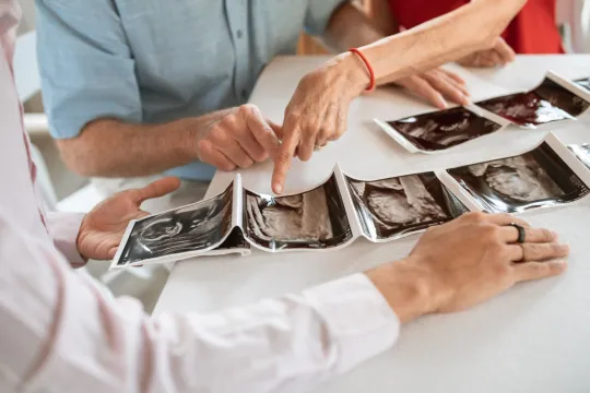 3D Ultrasound: What to Expect, Week by Week