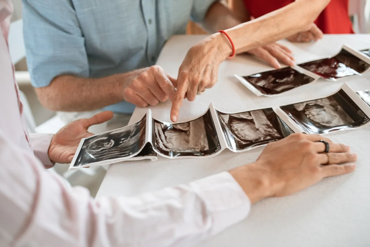 3D Ultrasound: What to Expect, Week by Week