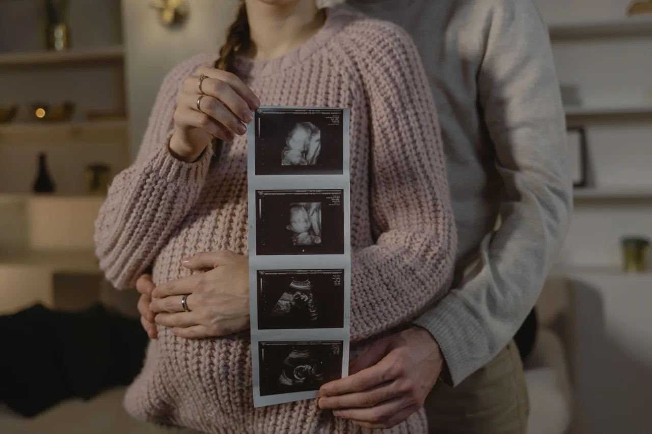 3D Ultrasound: What to Expect, Week by Week