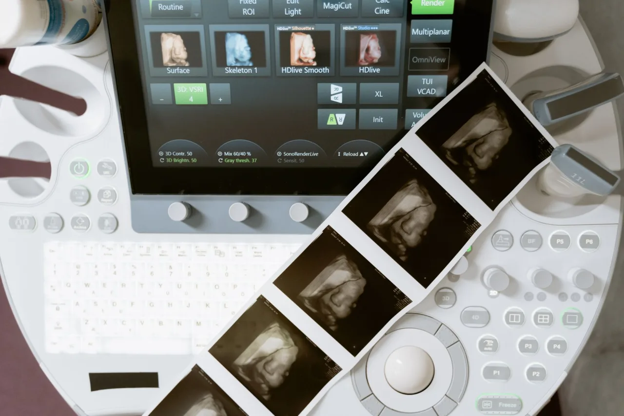 4 D Ultrasound Near Me: Find and Compare