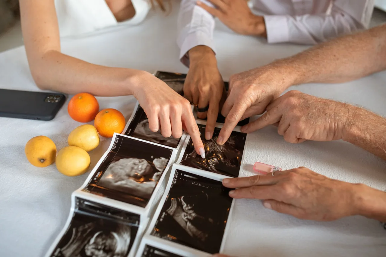 4 Week Ultrasound