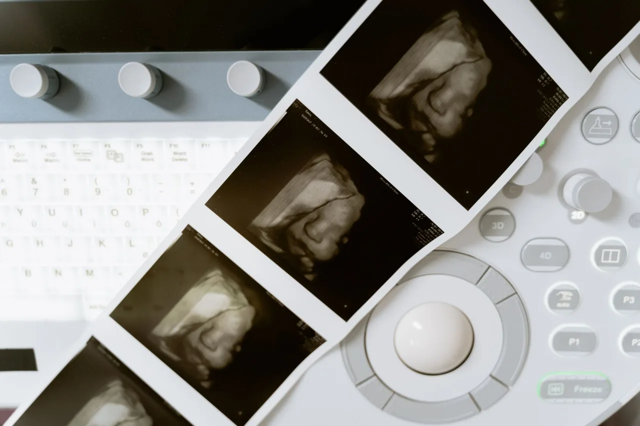 4D Ultrasound Near Me: How to Choose