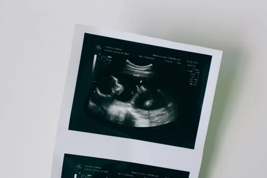 4D Ultrasound: What to Expect, Week by Week