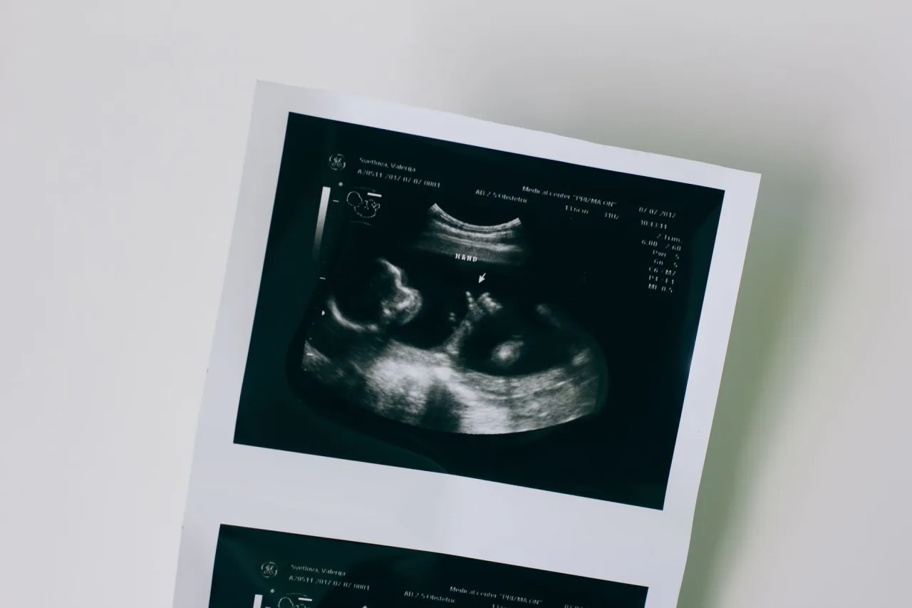 4D Ultrasound: What to Expect, Week by Week