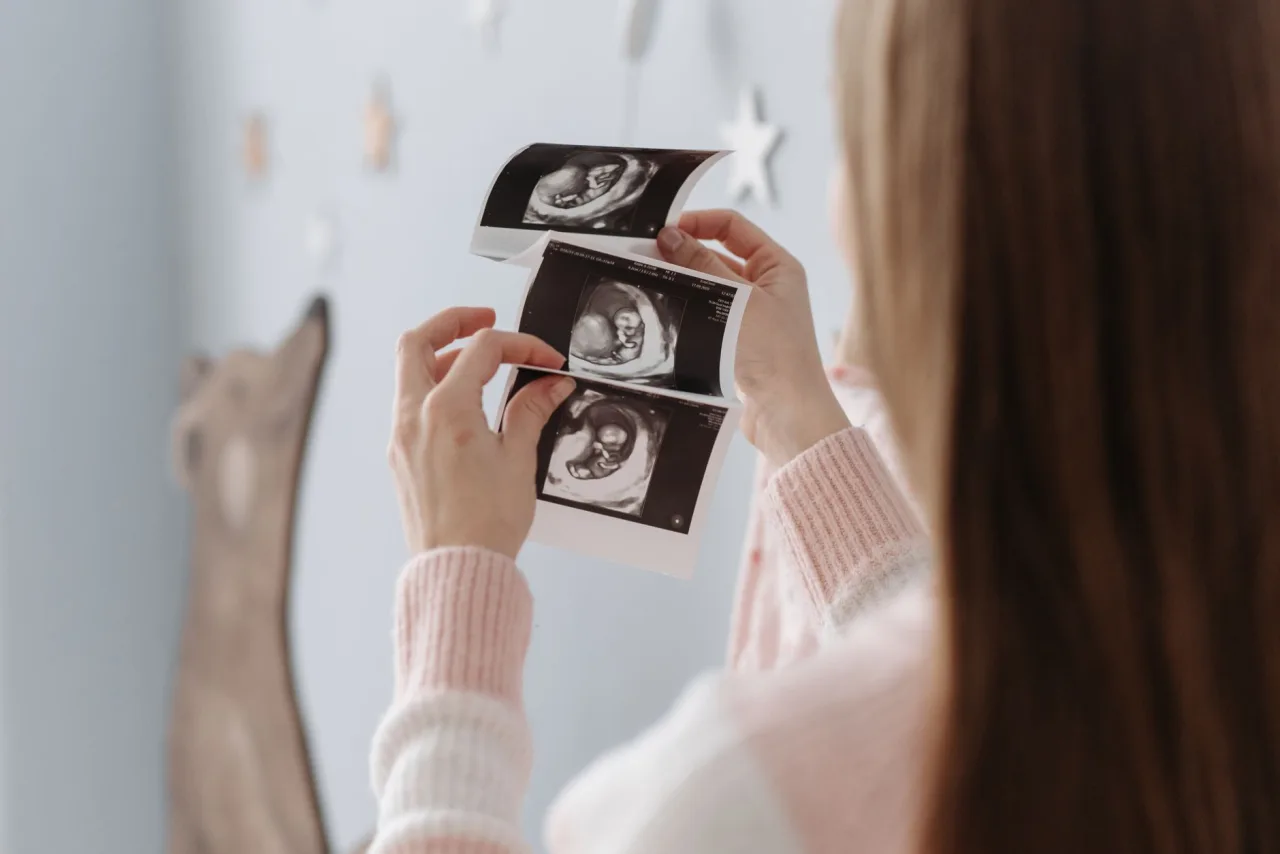 4D Ultrasound: What to Expect, Week by Week