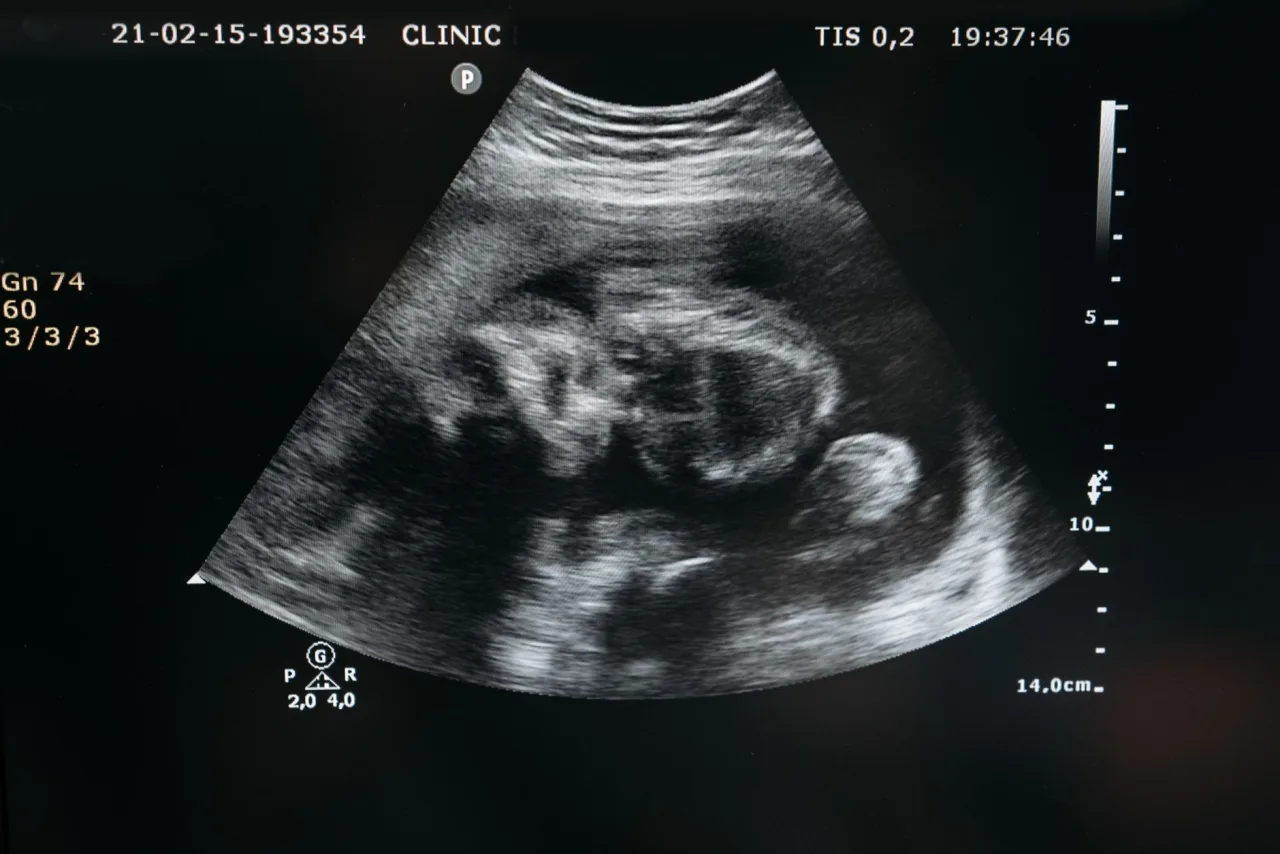 4D Ultrasound: What to Expect, Week by Week