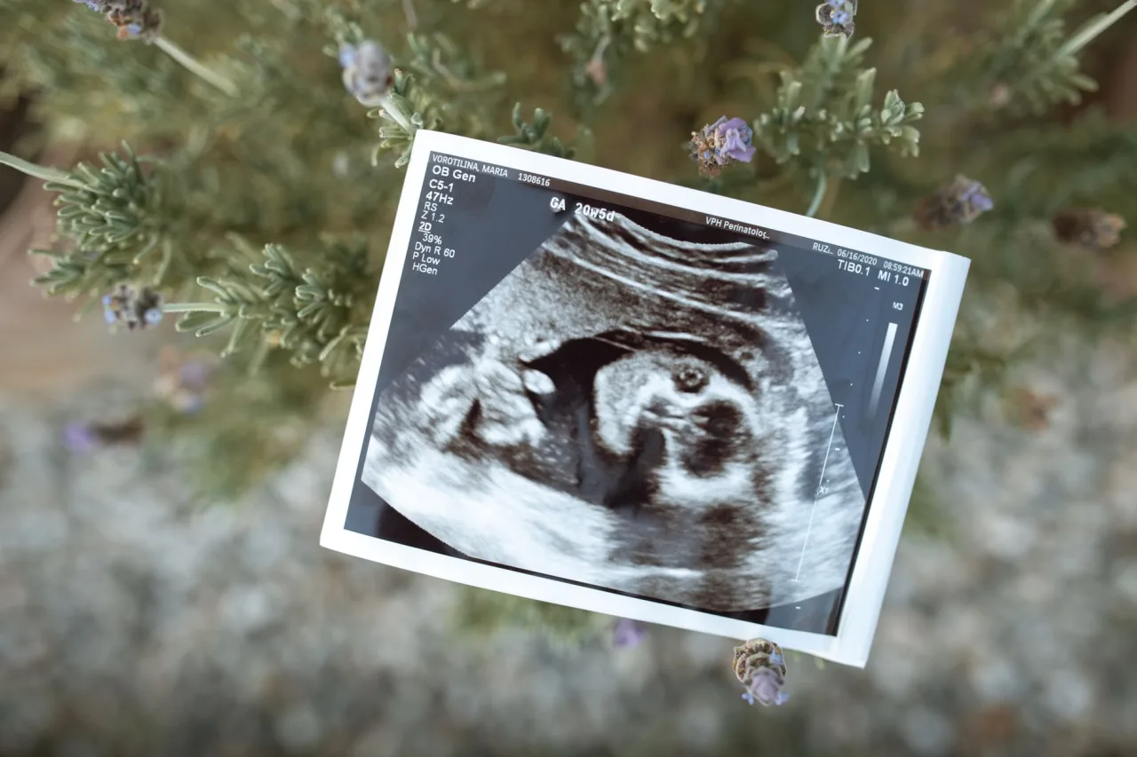 6 Week Ultrasound: What to Expect