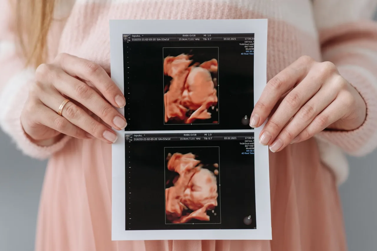 6 Week Ultrasound: What to Expect