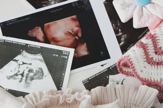 7 Week Ultrasound