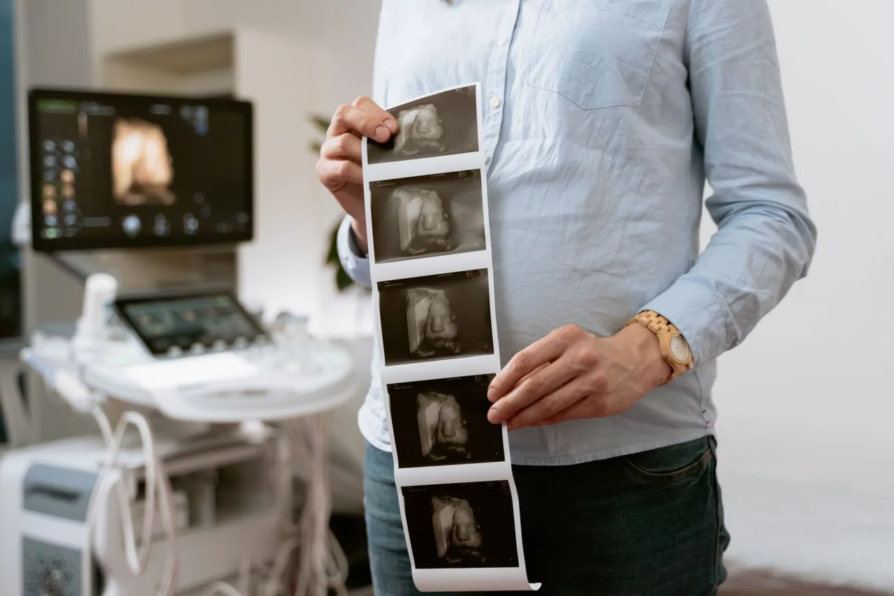 7 Week Ultrasound