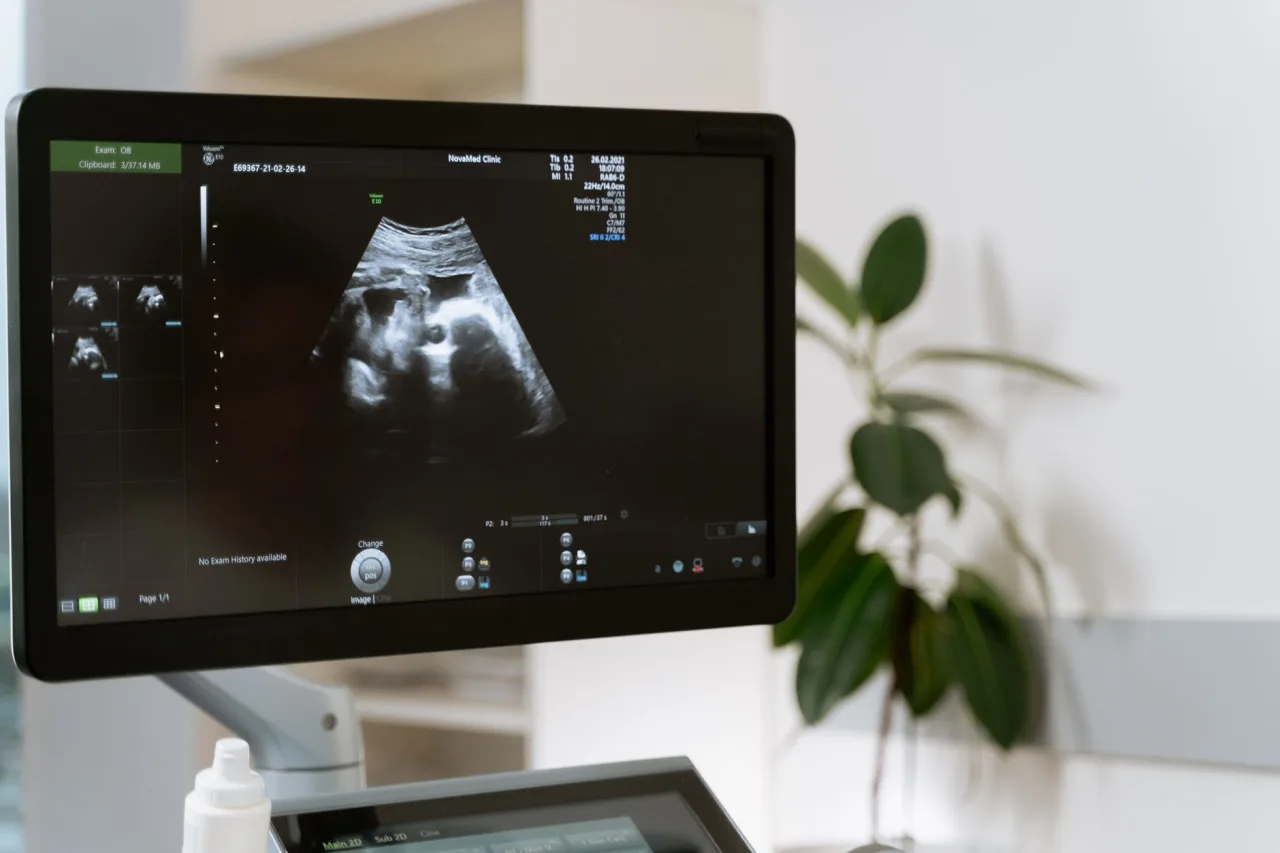 Abdominal Ultrasonography: 2026 Career Guide