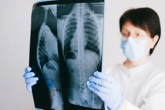 Abdominal X-Ray