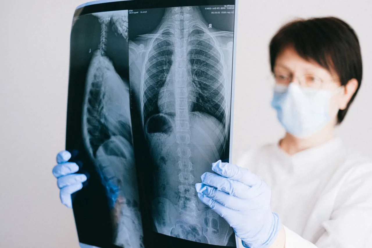 Abdominal X-Ray