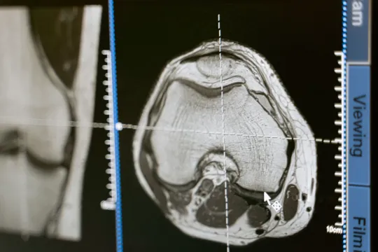 Anatomy Scan: What to Expect, Week by Week