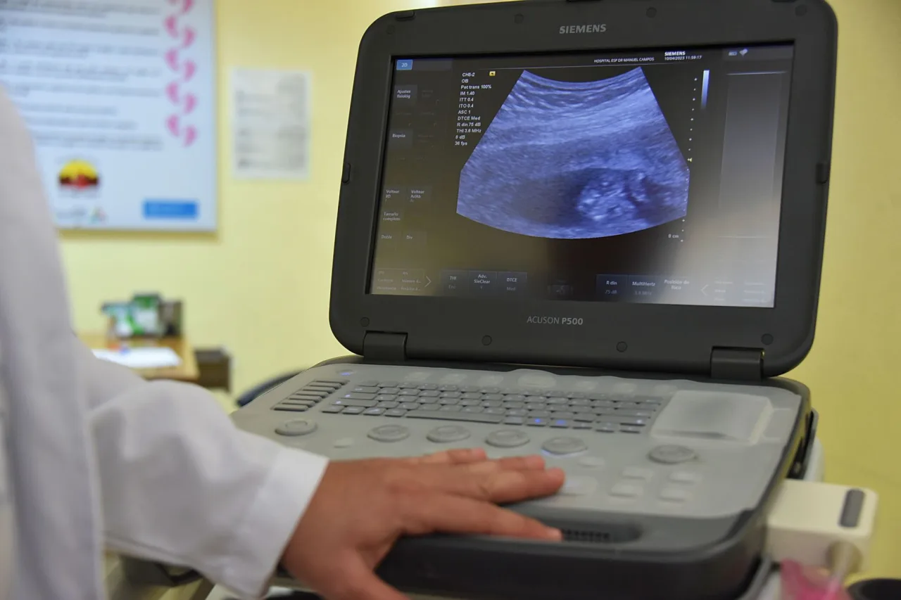 Ultrasound Machine 2026: Buyer's Guide