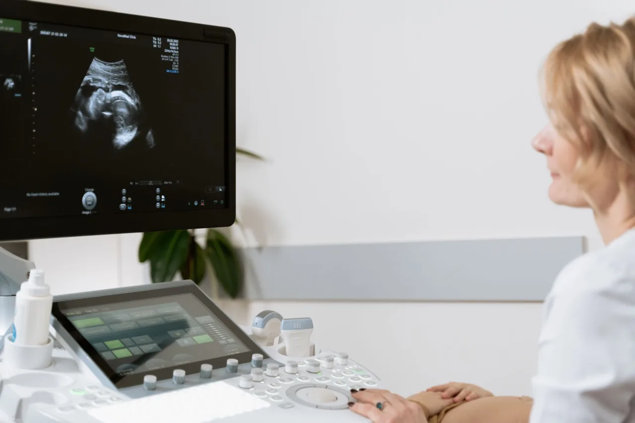 Ultrasound Machine 2026: Buyer's Guide