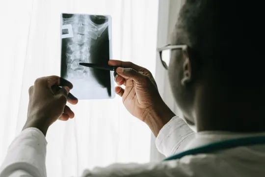 C Spine X-Ray: Uses and Procedure