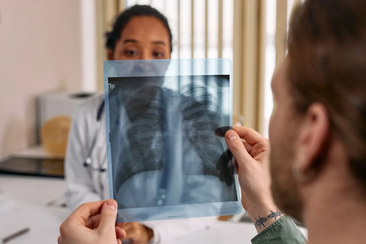 Chest X-Ray: Uses, Procedure & Results