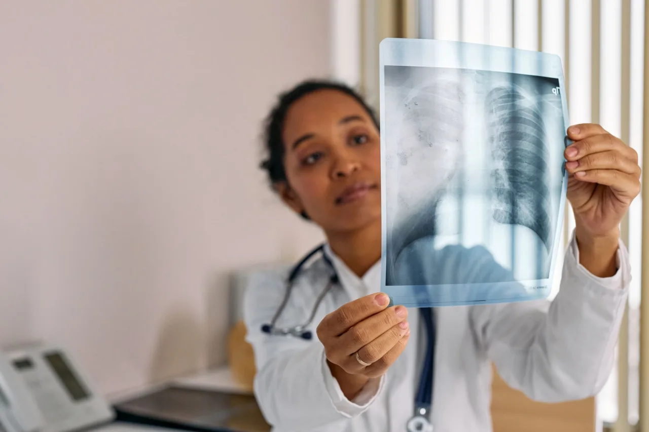 Chest X-Ray: Uses, Procedure & Results