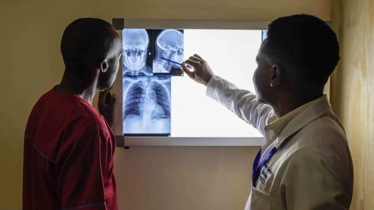 Chest X-Ray: A Patient's Guide