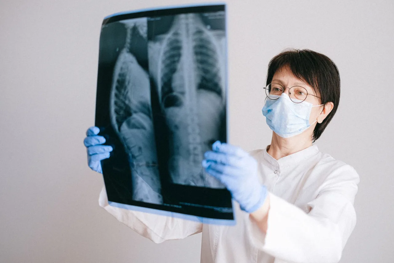 Chest X-Ray: A Patient's Guide