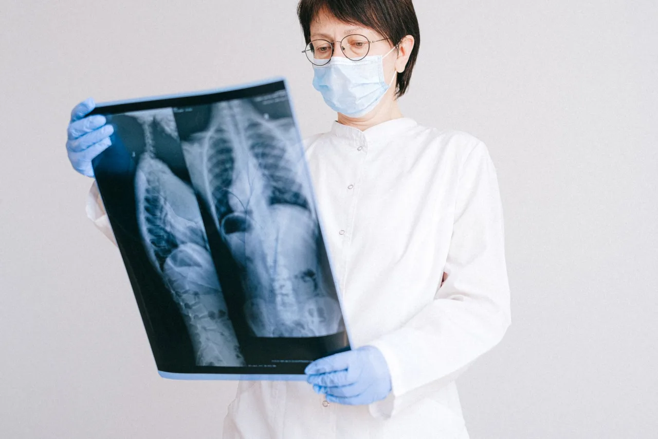 Chest X-Ray of Pneumonia