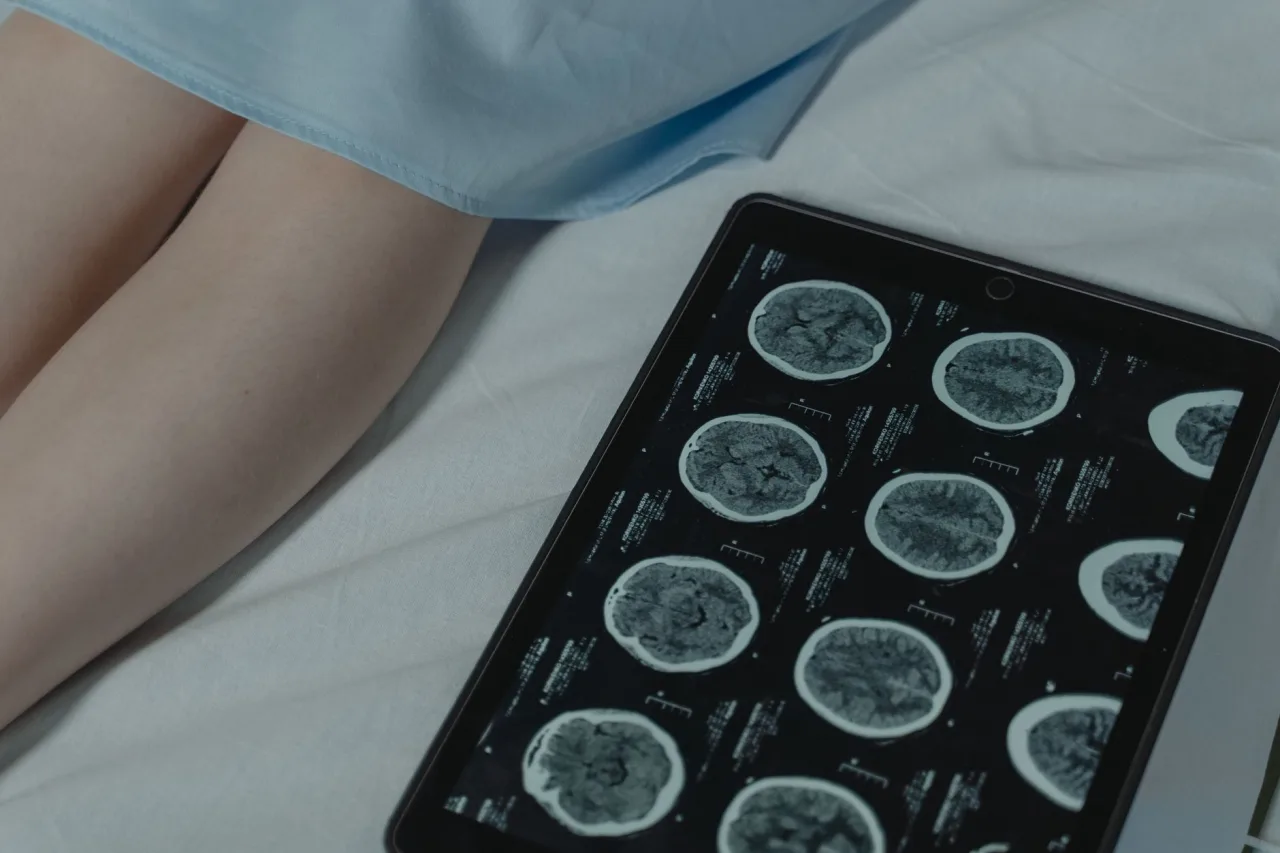 CT and MRI: Uses and Results