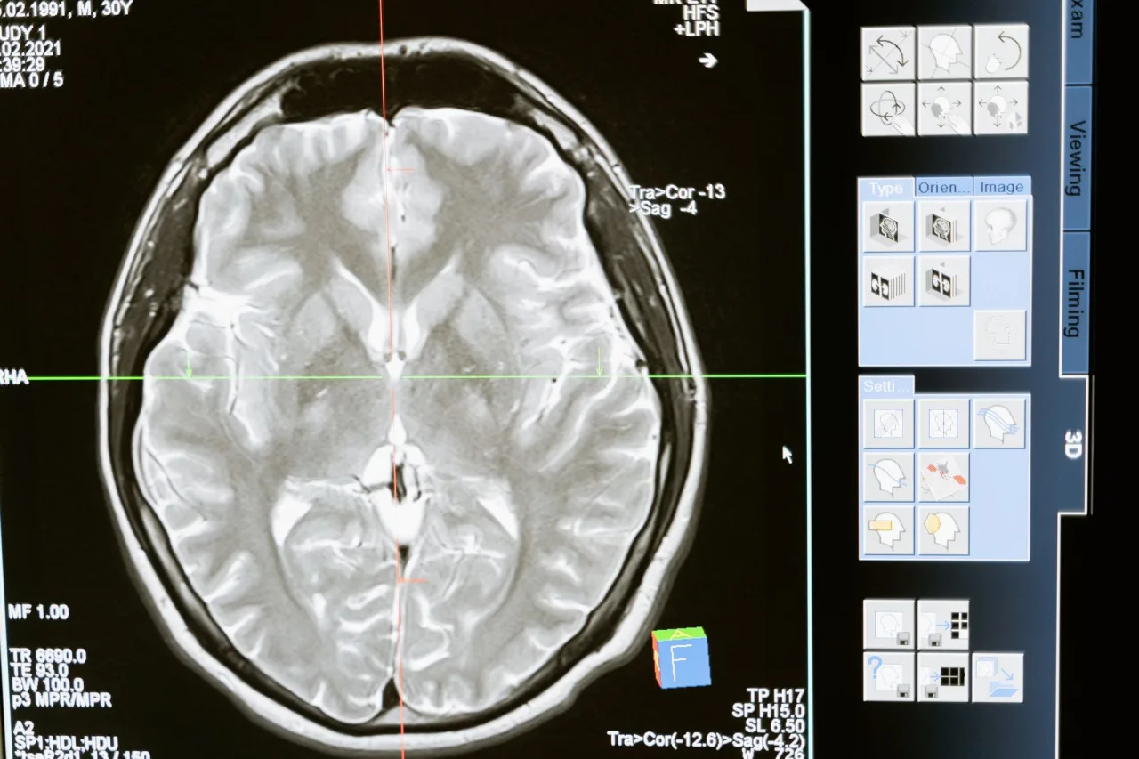 CT and MRI: Uses and Results