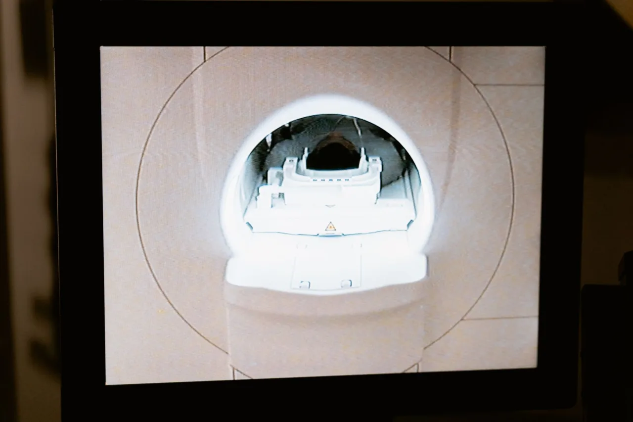 CT Scan Machine