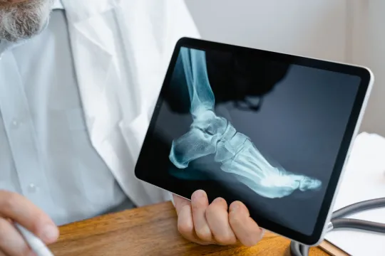 Foot X-Ray Normal