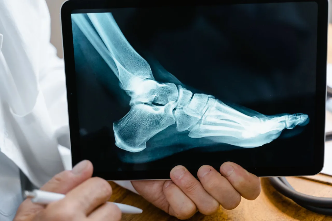 Foot X-Ray Normal