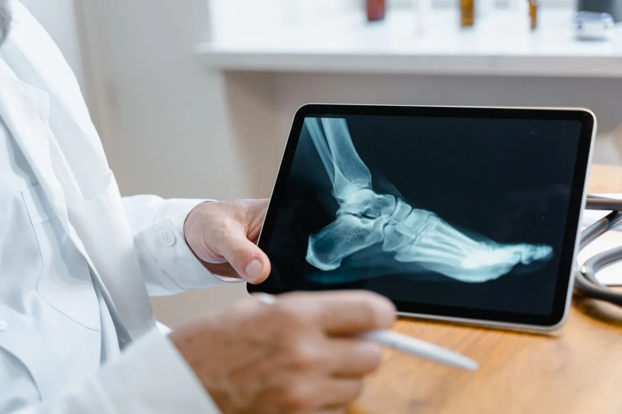 Foot X-Ray Normal