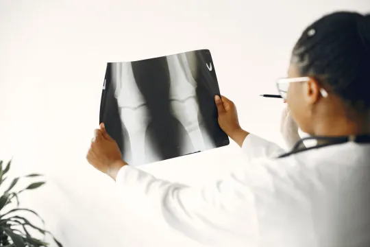Hip X-Ray