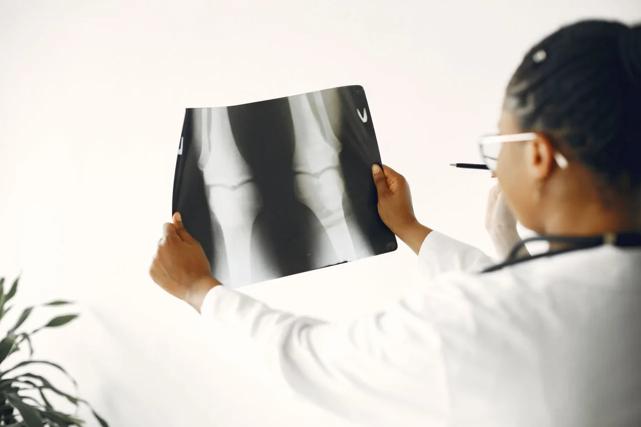 Hip X-Ray