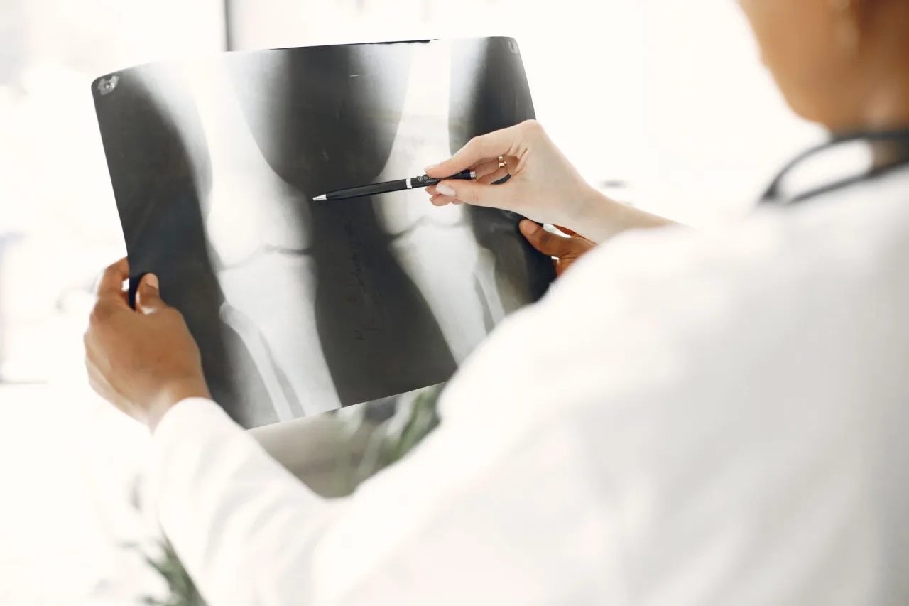 Hip X-Ray