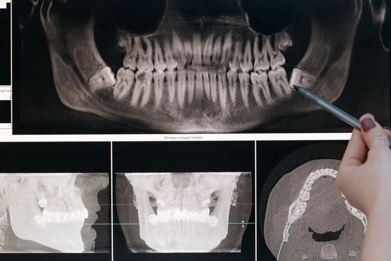 Imaging Near Me: Choose Any Clinic