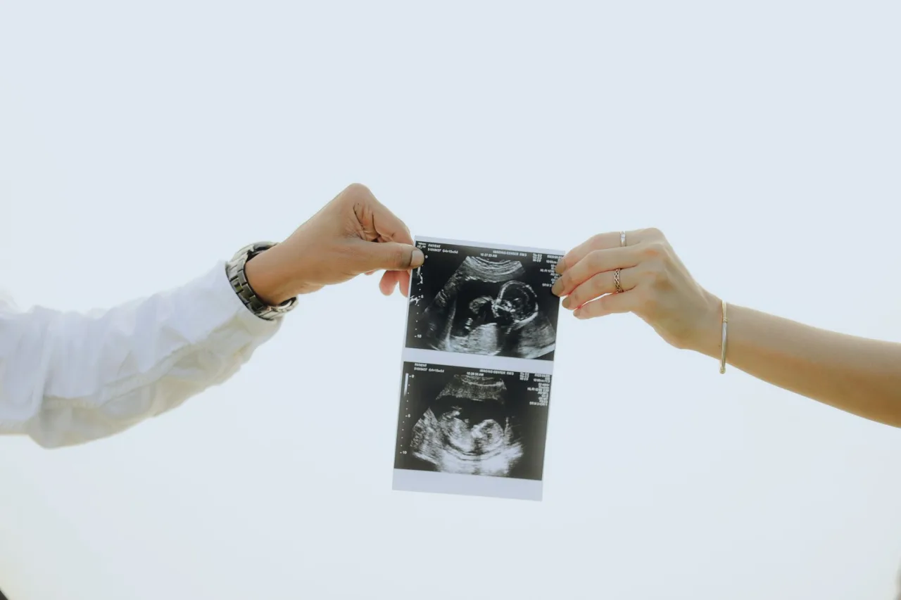 Kidney Sonogram