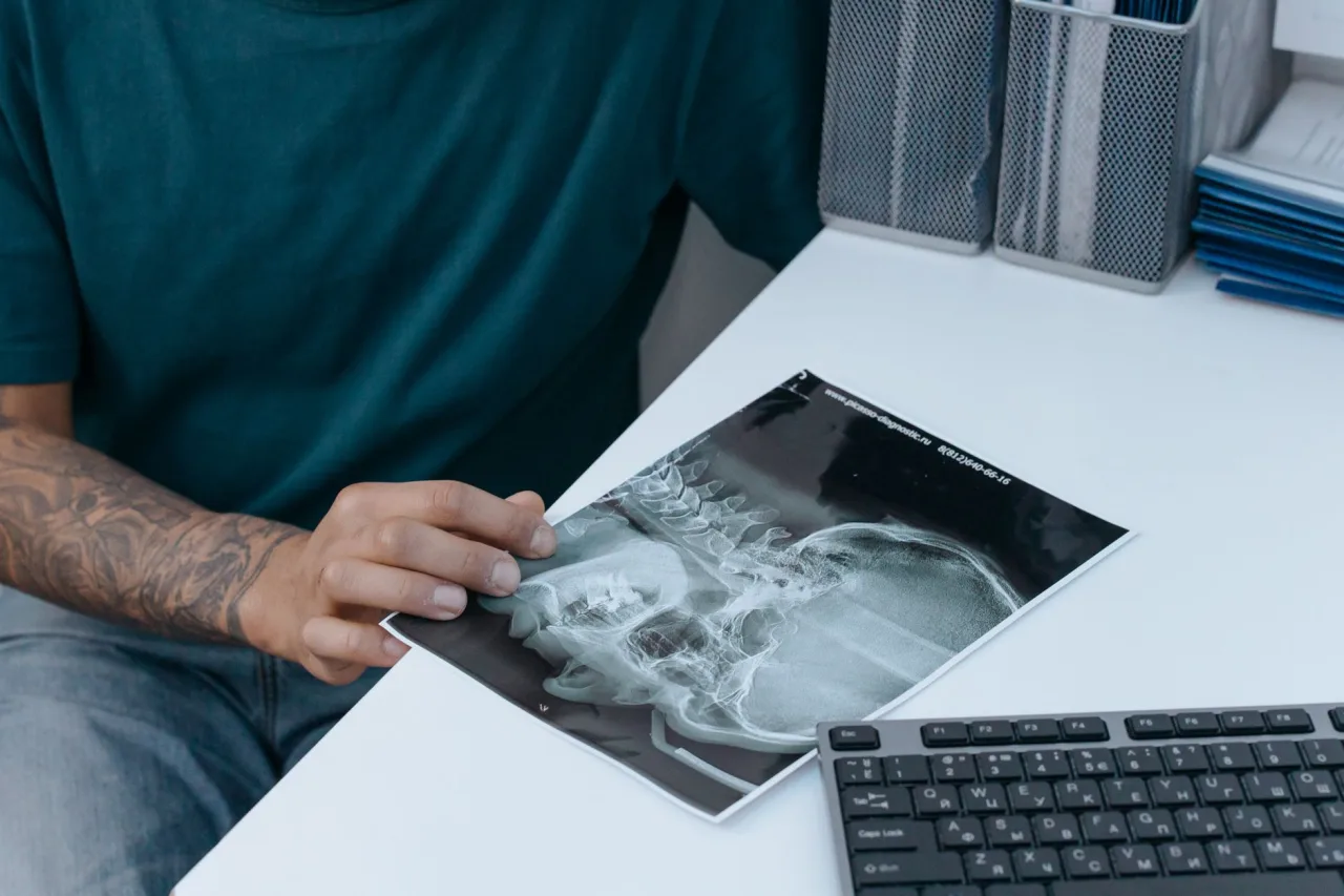 KUB X-Ray: Uses, Procedure & Results