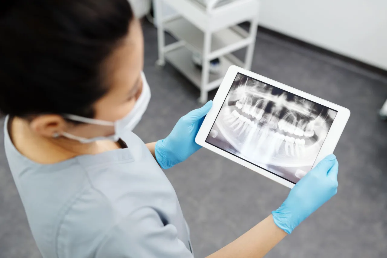KUB X-Ray: Uses, Procedure & Results