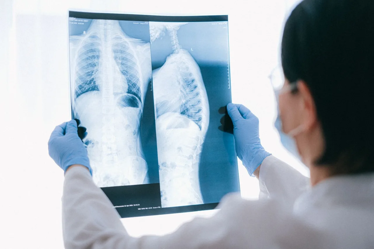 L Spine X-Ray