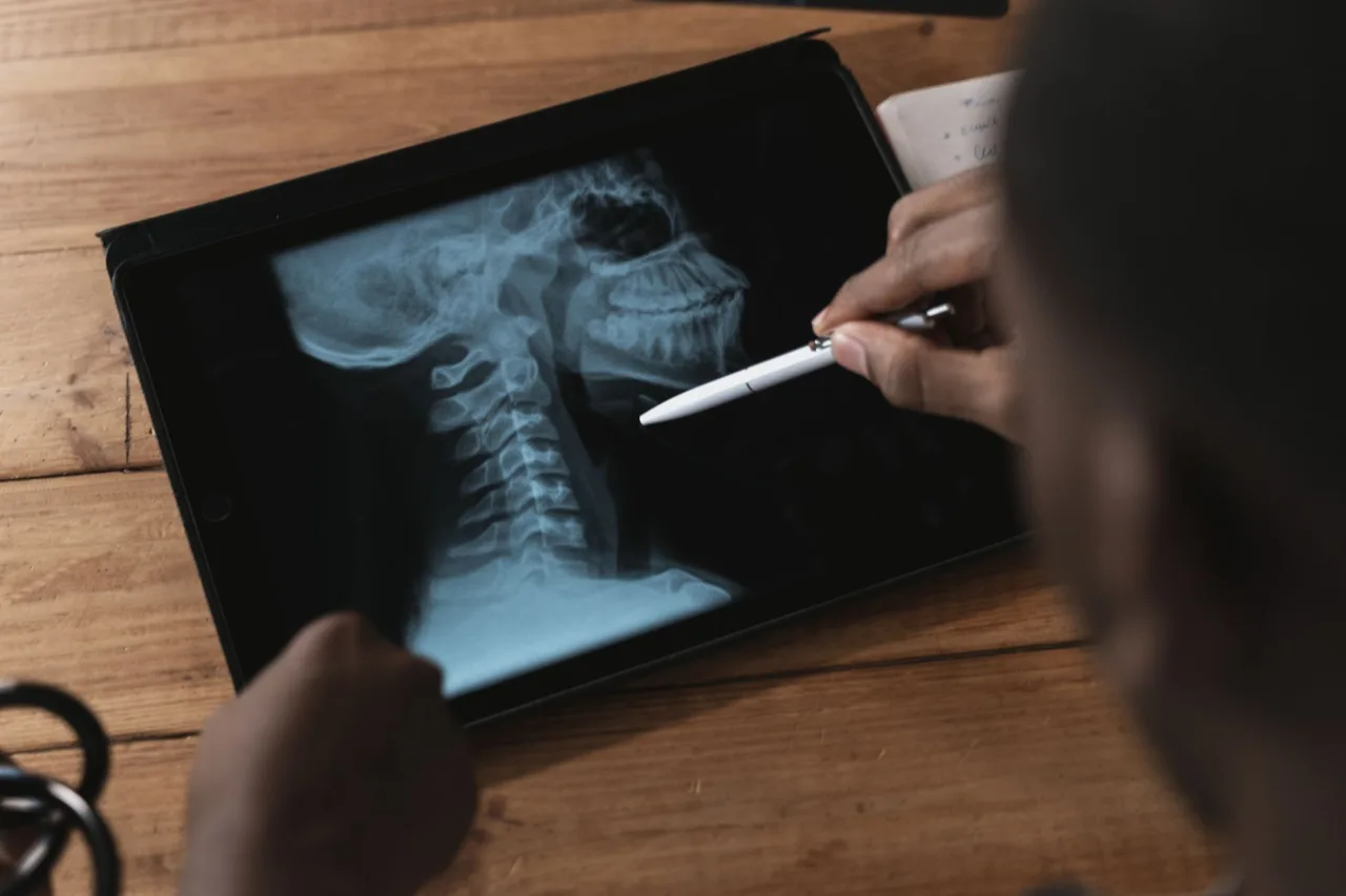 L Spine X-Ray