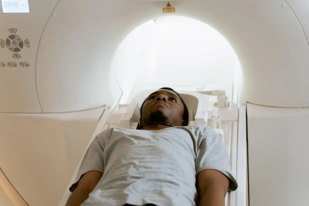 Low Dose CT Scan for Lung Cancer