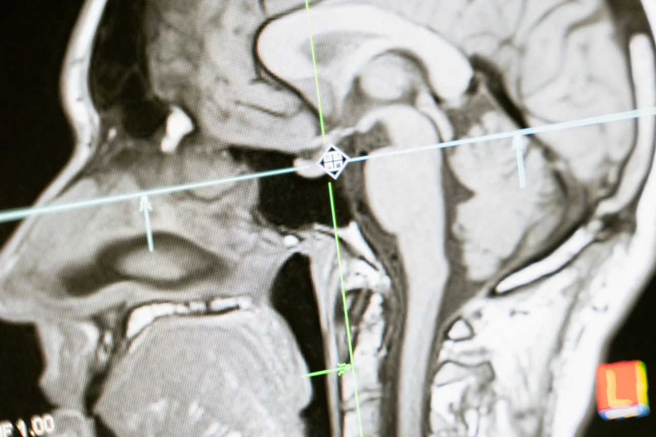 Mainstreet Radiology