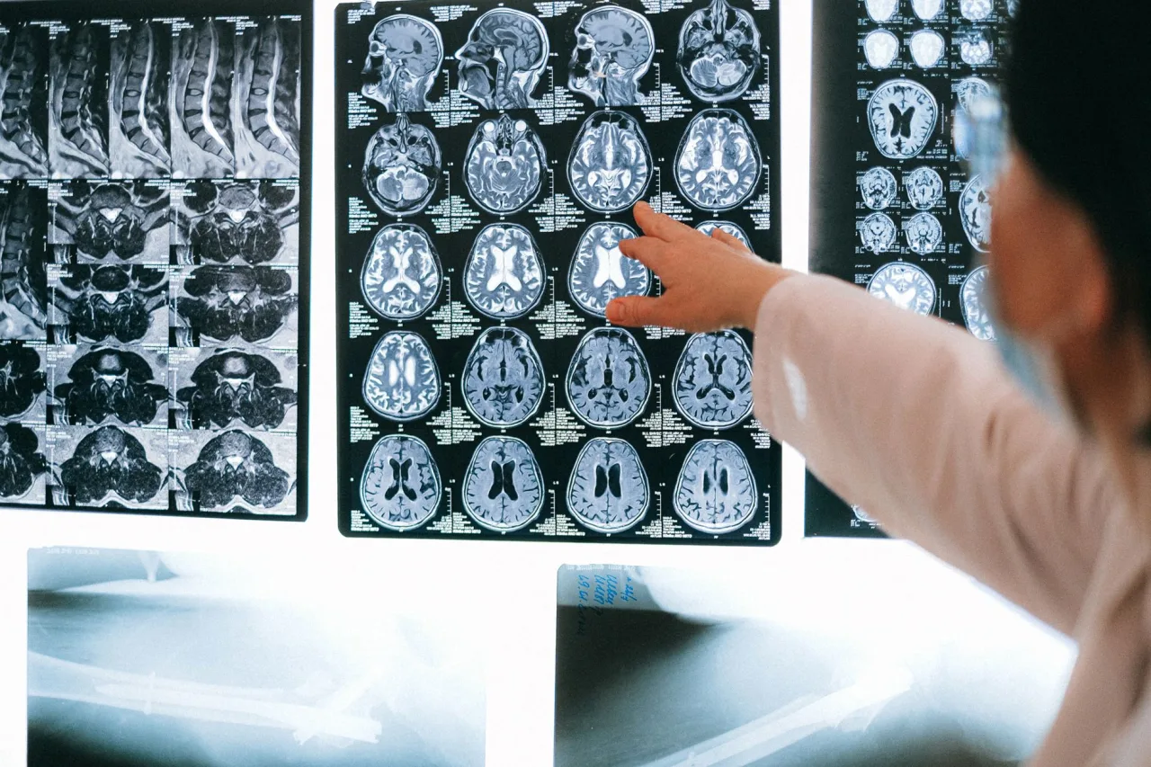 MRI Centers Near Me: How to Compare