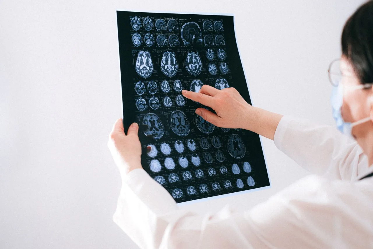 MRI and CT Scan: What to Expect