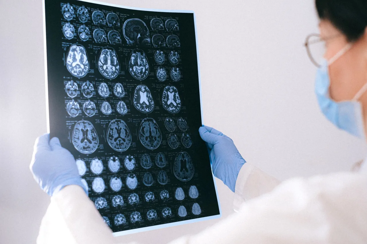 MRI and CT Scan: What to Expect