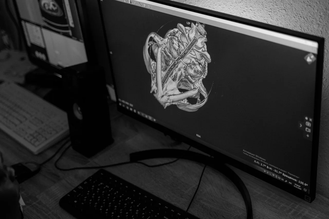 MRI Imaging: Uses, Procedure & Results